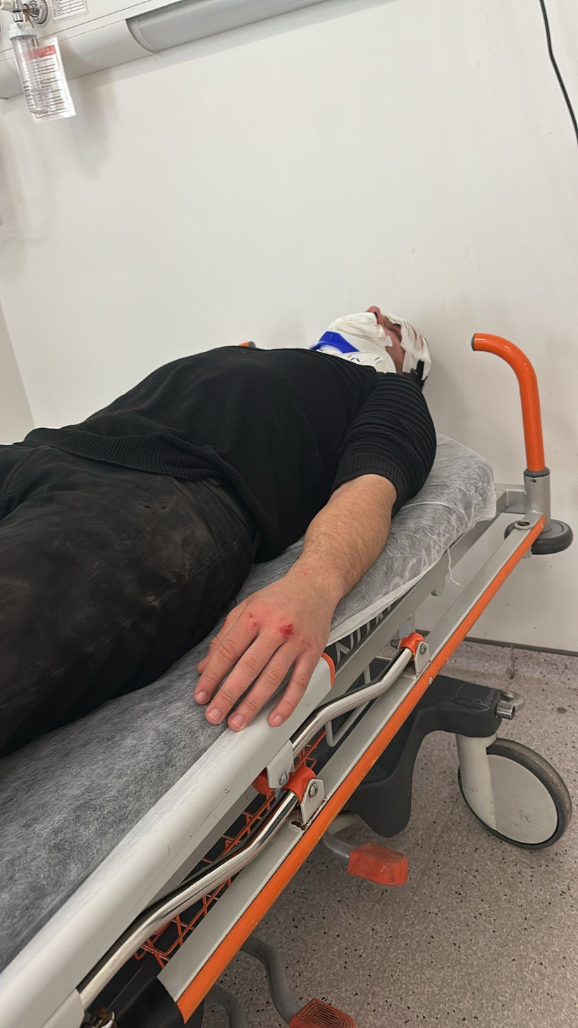 Polisten kaçarken çukura düştü - Resim : 1