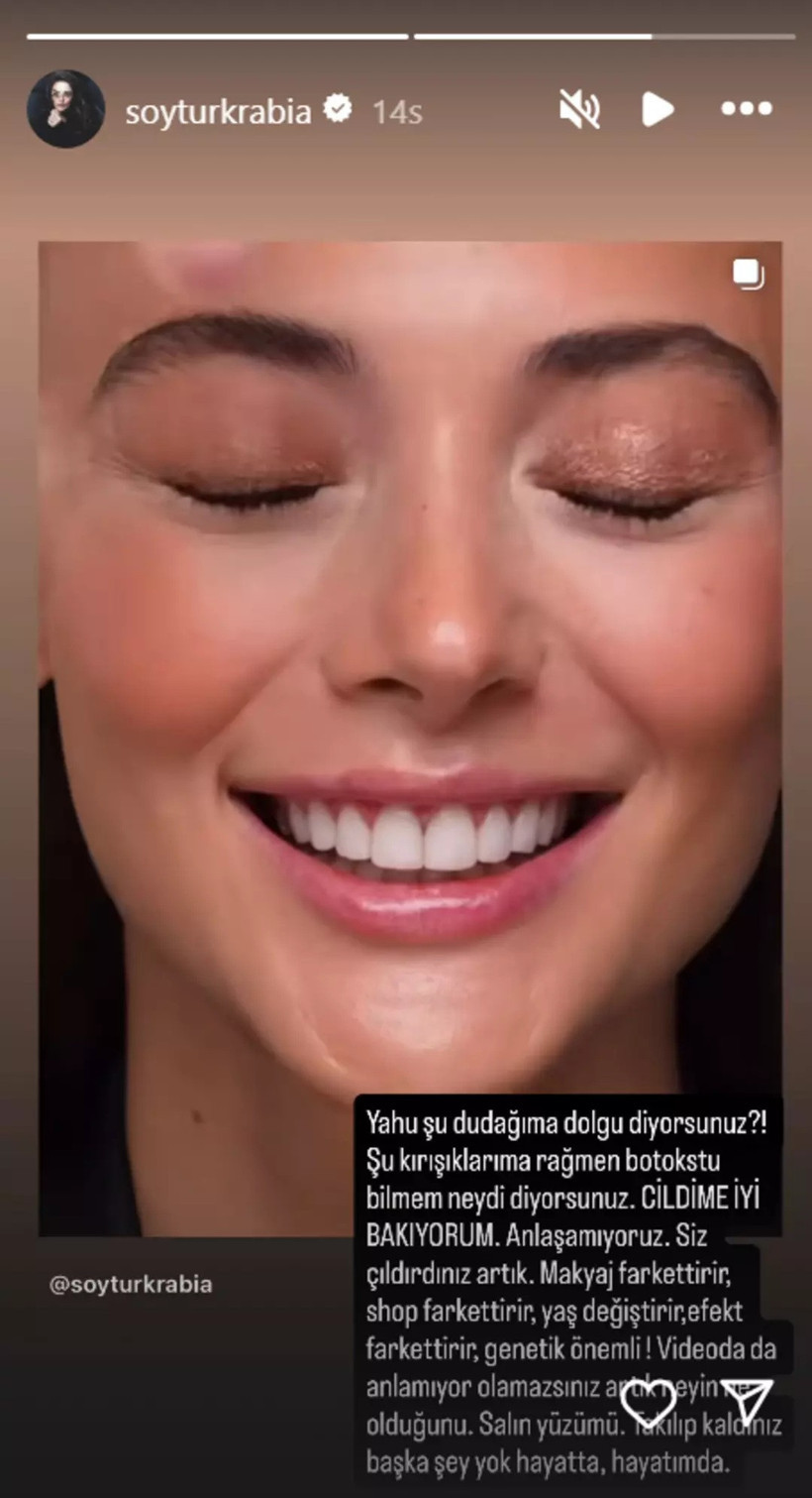 Rabia Soytürk estetik iddialarına tepki gösterdi: "Siz çıldırdınız artık!" - Resim : 1