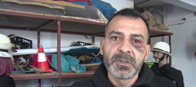 Sosyal medya fenomeni Adem Ocaktan'ı öldüresiye dövdüler - Resim : 1