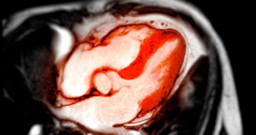 Araştırmalar ortaya koydu: Hangi kan grubu daha riskli? - Resim: 8