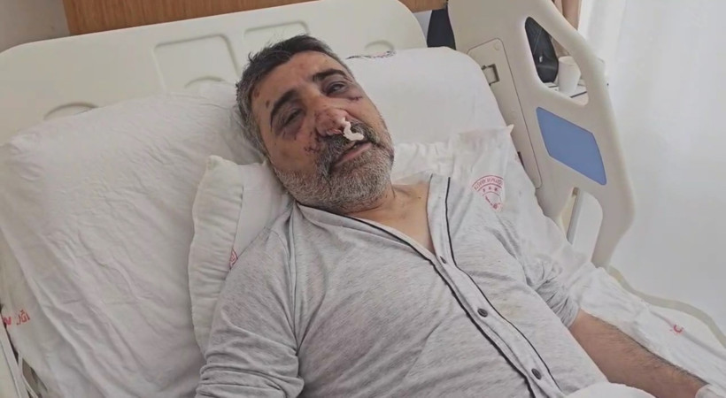 İngiliz boksörün dövdüğü taksici konuştu: Gözlerimi çıkarmaya çalıştı, ısırıp öptü - Resim : 1