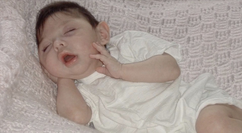 Büyük mucize: Beyni olmadan dünyaya gelmişti, şimdi 20 yaşında - Resim : 1