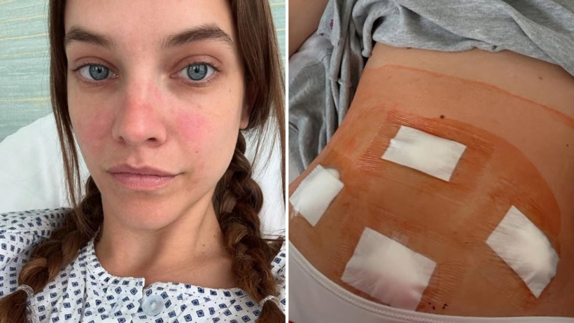 Barbara Palvin yıllardır gizlediği hastalığı açıkladı - Resim : 1
