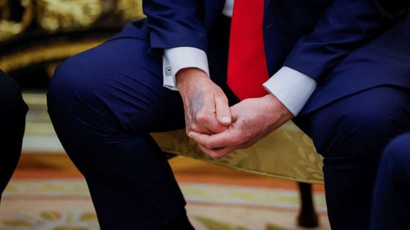 Beyaz Saray'dan Trump'ın eliyle ilgili açıklama geldi - Resim: 2