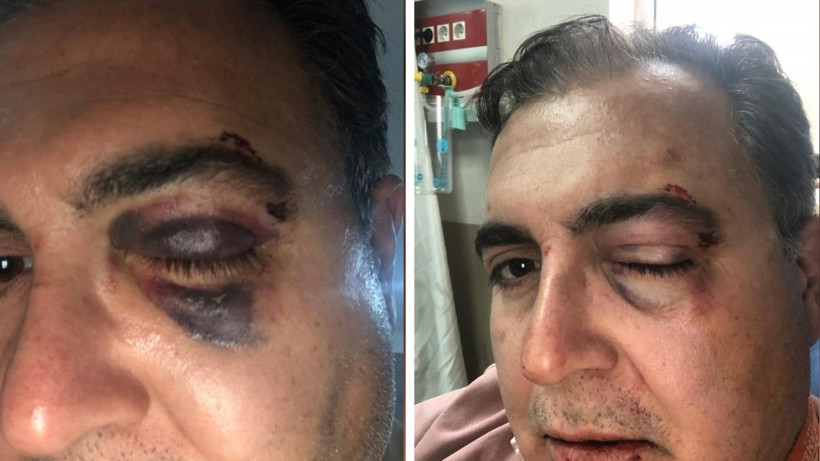 Sokakta kedileri besleyen iş insanı saldırıya uğradı - Resim : 1