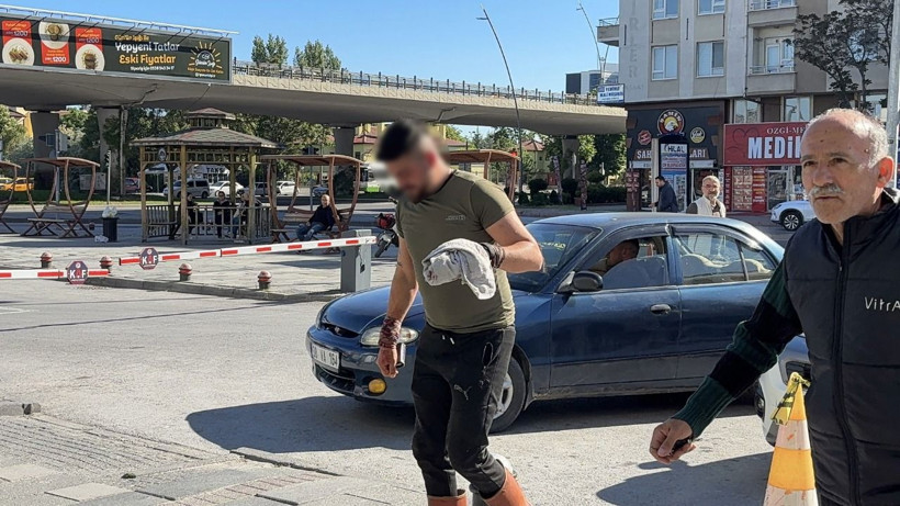 Acemi kasaplar acile akın etti - Resim: 6