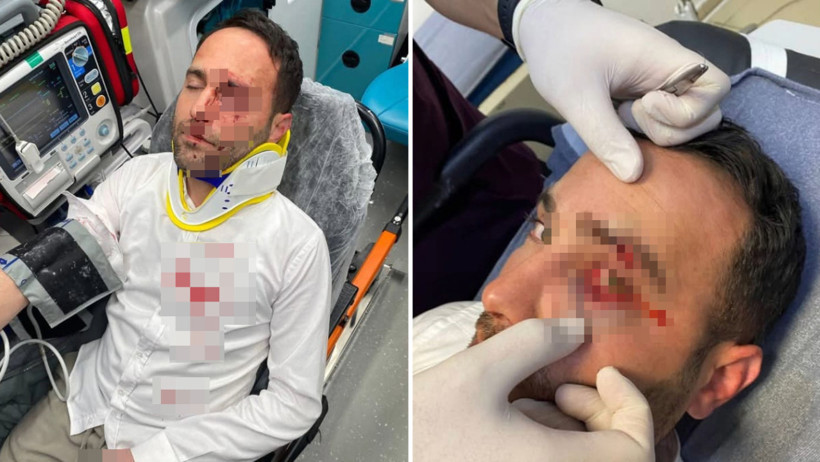 Komşusu dövüp telle boğmaya çalışmıştı: En sonunda imam sırtından bıçakladı - Resim : 1