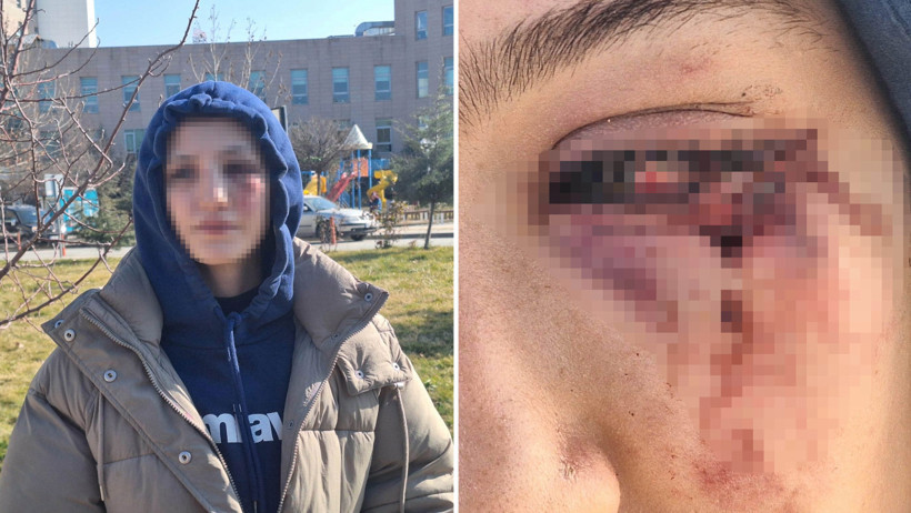 Kız arkadaşını dövüp, köpeğini tekmeleyen şüpheli tutuklandı - Resim : 3