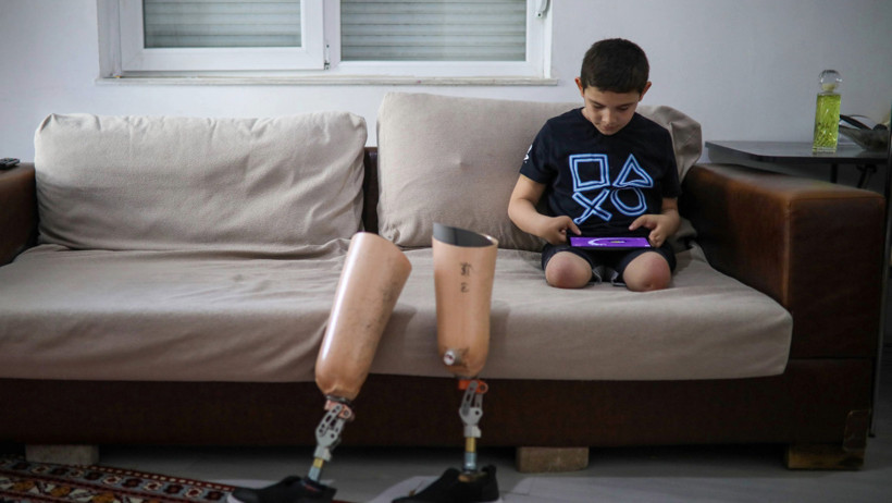 Çocuğu için kredi çekmişti: Hem protezi kullanamıyor hem de hapse girebilir - Resim : 4