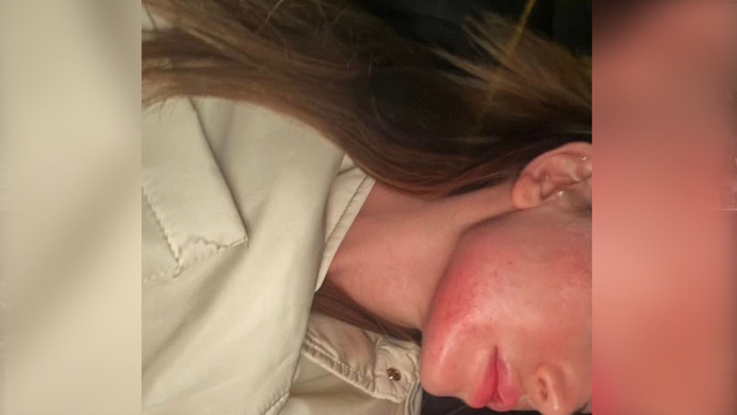 Danla Biliç eski sevgilisi tarafından darp edildi - Resim : 1