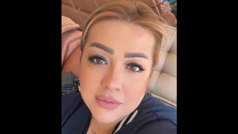 Güzellik uğruna tanınmayacak hale geldi - Resim : 1