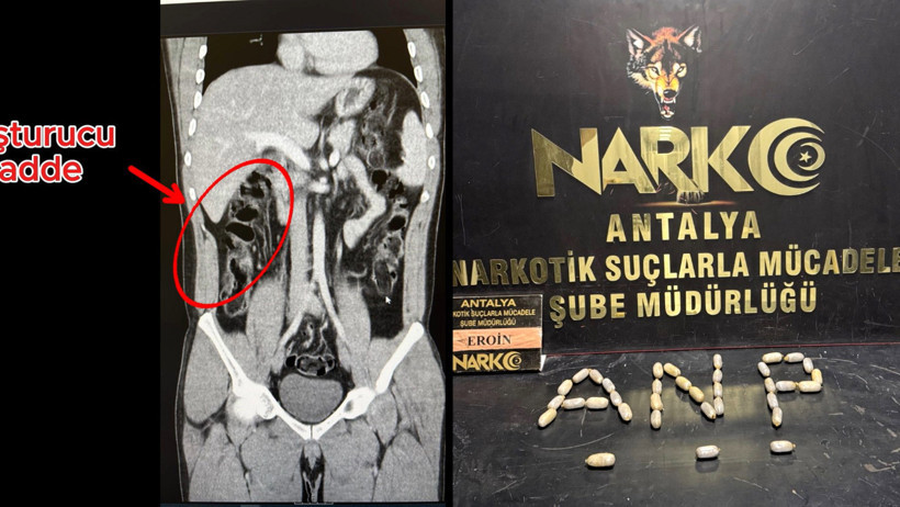 Torbacılara MR: Midesinden eroin kapsülleri çıktı - Resim : 1