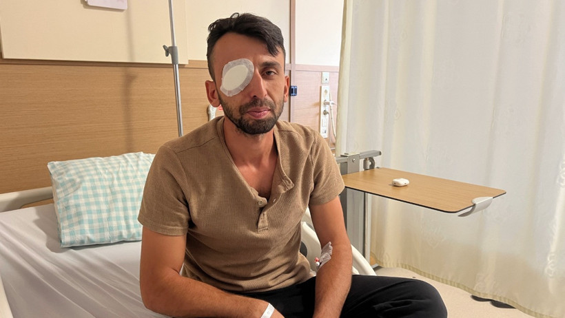 Gürültü yaptığı için uyarılınca ateş açtı! Temizlik görevlisi sağ gözünü kaybetti - Resim : 1