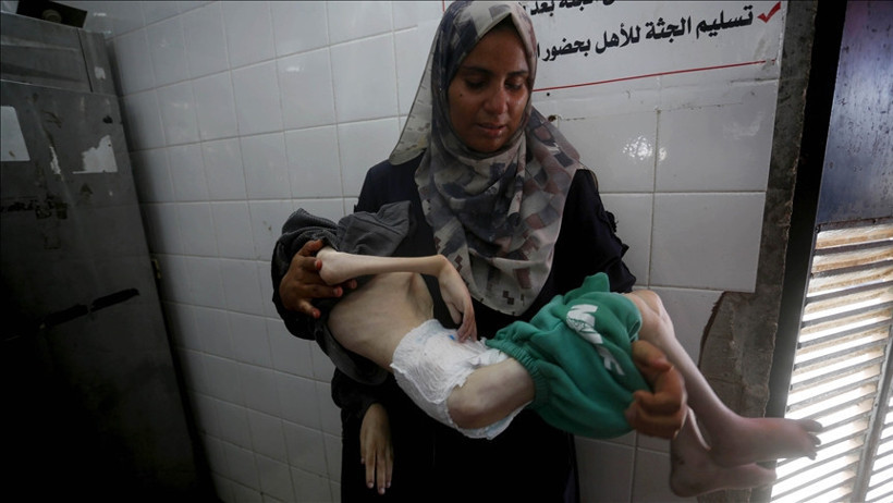 13 yaşındaki Tamir, annesinin kollarında açlıktan öldü - Resim : 1