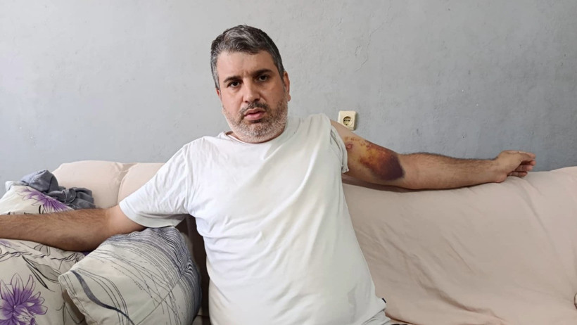 Miras kavgası kanlı bitti: Dayı, yeğenini öldüresiye dövdü - Resim : 2