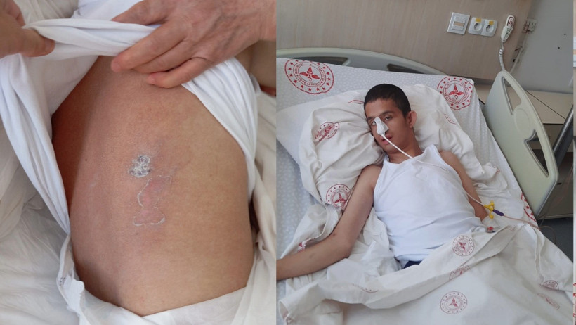 Yürüyerek getirdiği torununu yoğun bakımda geri aldı - Resim : 1