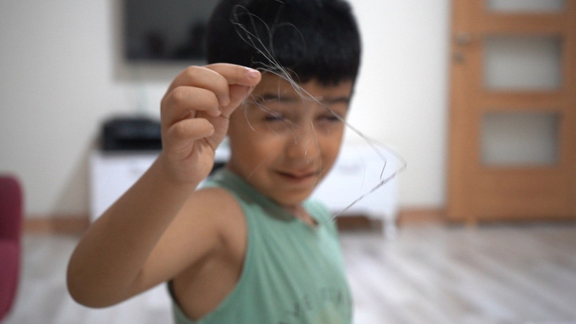 3 yıl sonra fark edildi: 6 yaşındaki çocuğun vücudunda kateter unutulmuş - Resim : 2