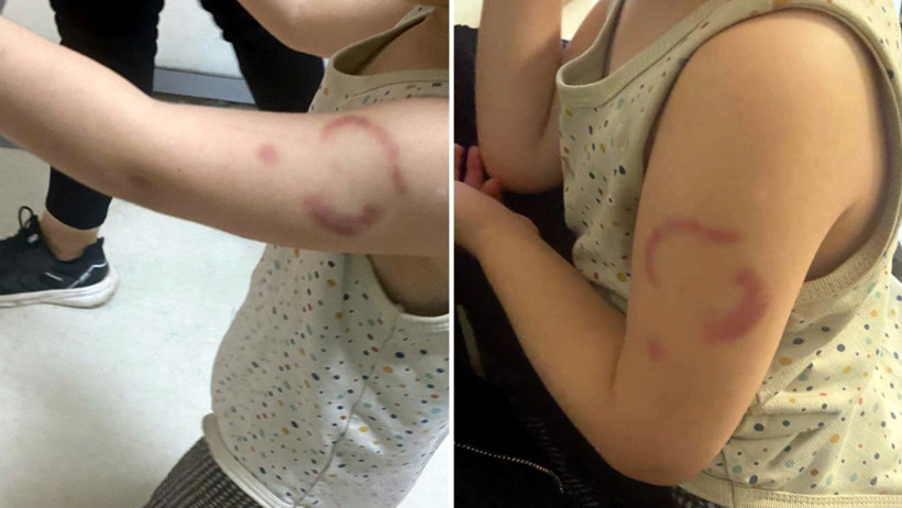 3 yaşındaki öğrencisini ısıran cani öğretmen tutuklandı - Resim : 3