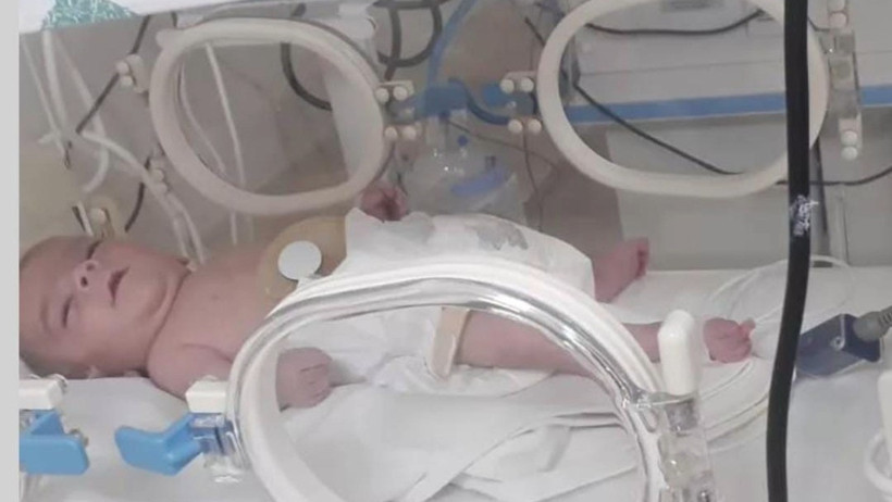 Bir yenidoğan skandalı daha! Kuvözde şiddet gördü, engelli kaldı - Resim : 1