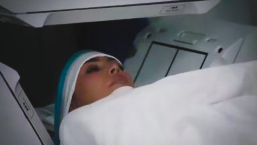 Kim Kardashian: Beyin anevrizması geçirdim - Resim : 1