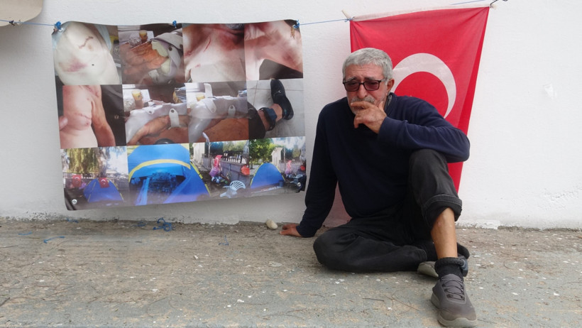 Evlendi, bıçaklandı, affetti, evinden oldu: “İyi niyetimden vuruldum” - Resim : 2