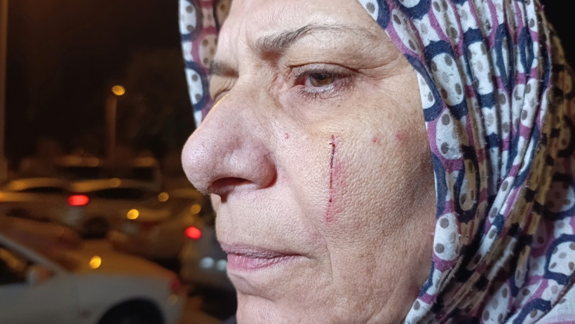 Komşu dehşeti: Babanın dişlerini kırdı, anne ve oğlunu bıçakladı - Resim : 2