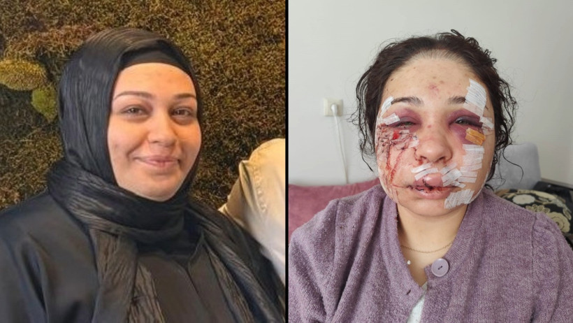 "Güzelliğini elinden alacağım" deyip yüzünü kesti: Serbest kaldı - Resim : 1