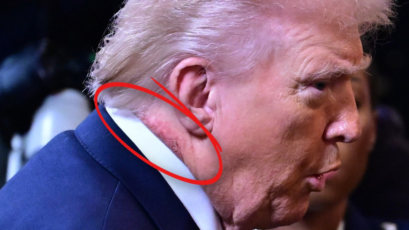 ABD’de gündem Trump’ın kızarıklığı - Resim : 1