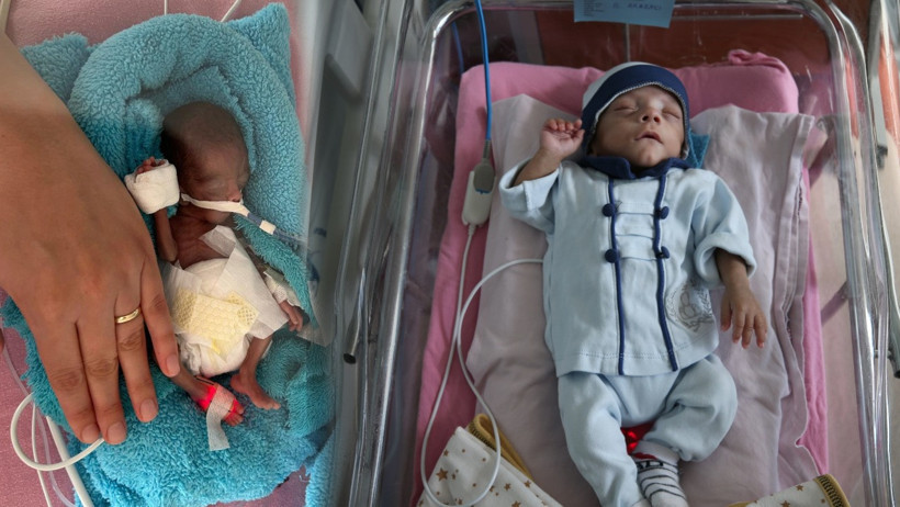 350 gram doğmuştu... R&uuml;zgar bebek 240 g&uuml;n sonra başardı - Resim : 3