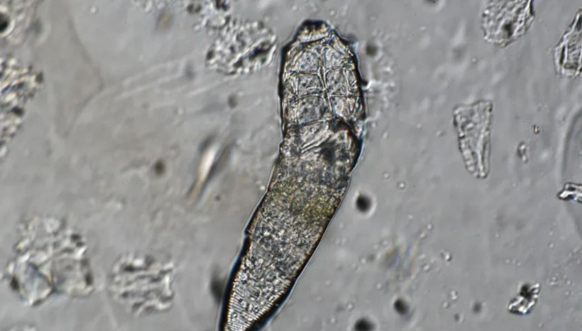 Geceleri uyurken bu küçük canlılar yüzünüzde dolaşıyor - Resim : 1