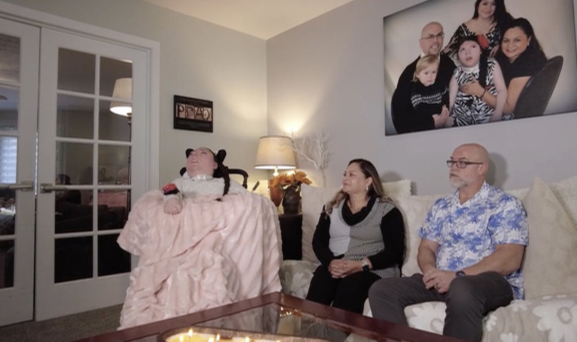 Büyük mucize: Beyni olmadan dünyaya gelmişti, şimdi 20 yaşında - Resim : 2