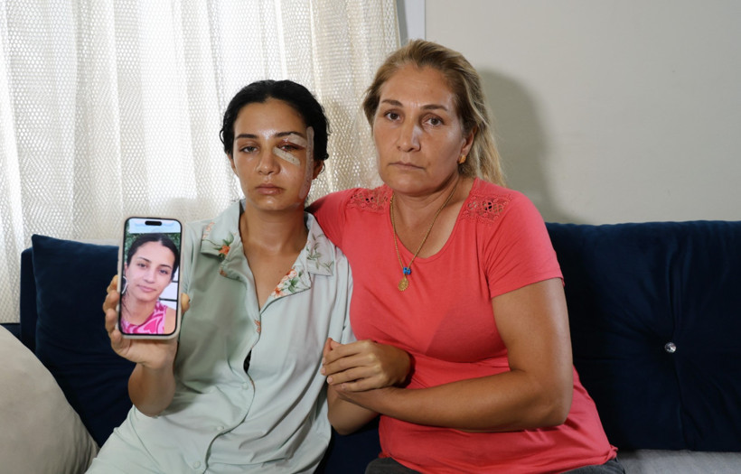 Öldüresiye dövüp serbest kaldı, kadının isyanı sonrası tutuklandı - Resim : 2