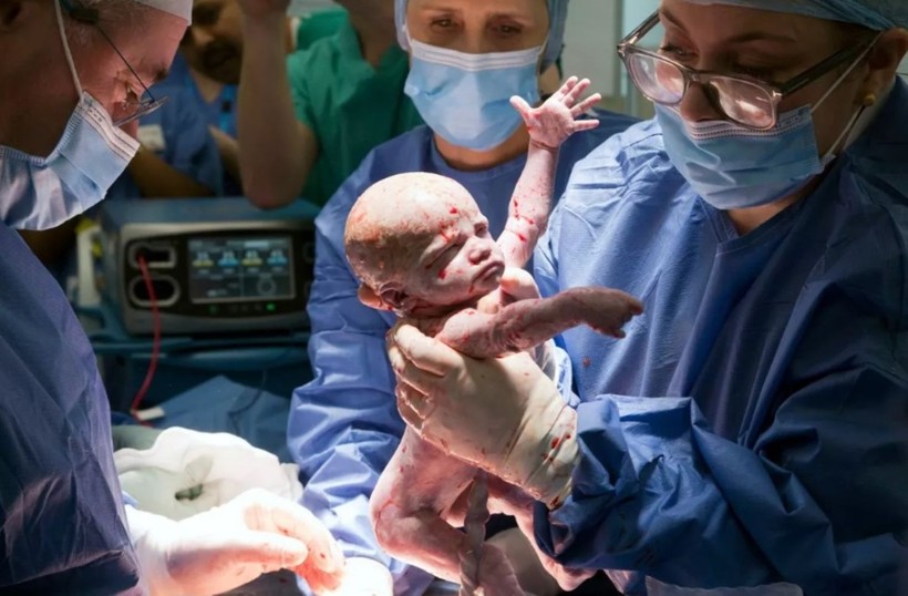 Teyzesinin rahminden doğan mucize bebek - Resim: 7