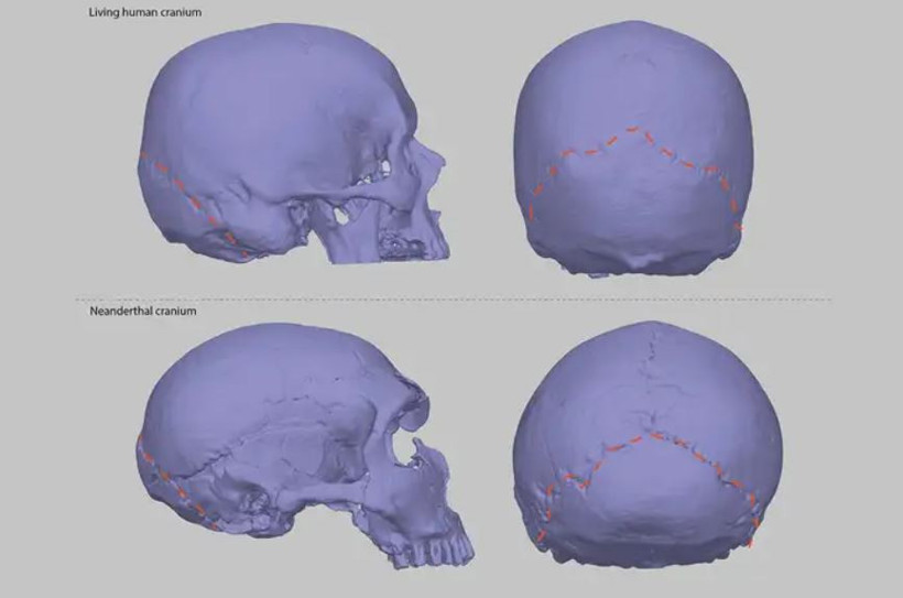 Şiddetli baş ağrınızın suçlusu Neandertaller olabilir - Resim : 1