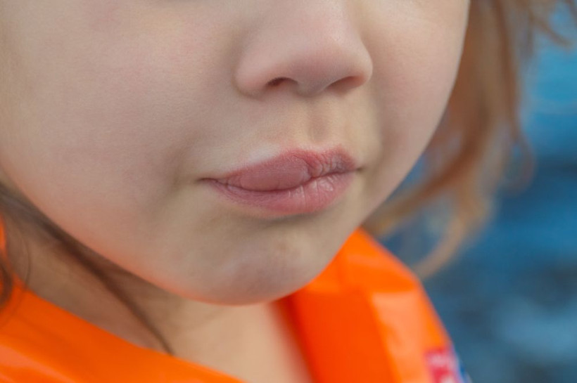 Uzmanı anlattı: Dudaklarınız sağlığınızla ilgili ne anlatıyor? - Resim: 10