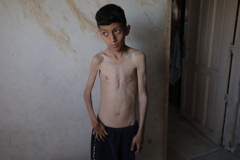 Gıda krizi değil insani felaket - Resim: 2