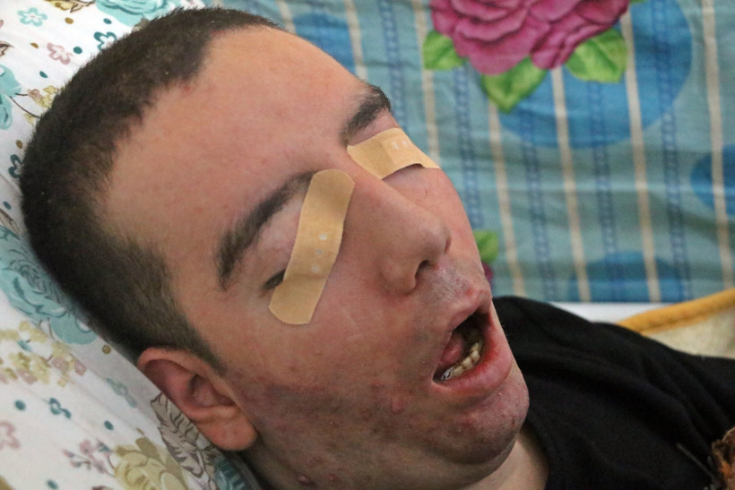 Gözlerini kapatamadı ama hayata direndi: Halil Özçelik 13 yıl sonra veda etti - Resim : 3