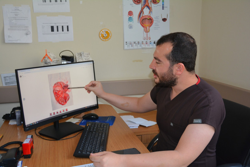 Karın ağrısı şikayetiyle gitti, böbreğinden dev kist çıktı - Resim : 1