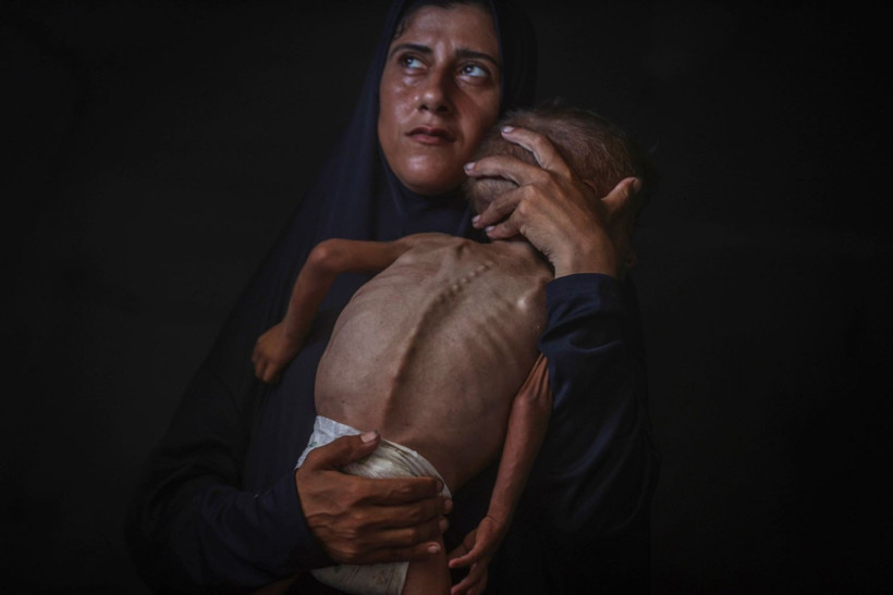 Dünyayı şoke eden kareler... Çöp poşetinden yapılmış bezden başka bir şeyi yok - Resim: 20
