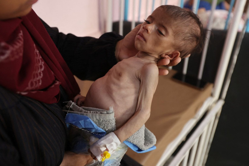 Gazze'de yardım sistemi çöktü: BM görevlileri bile açlıktan bayılıyor - Resim: 5