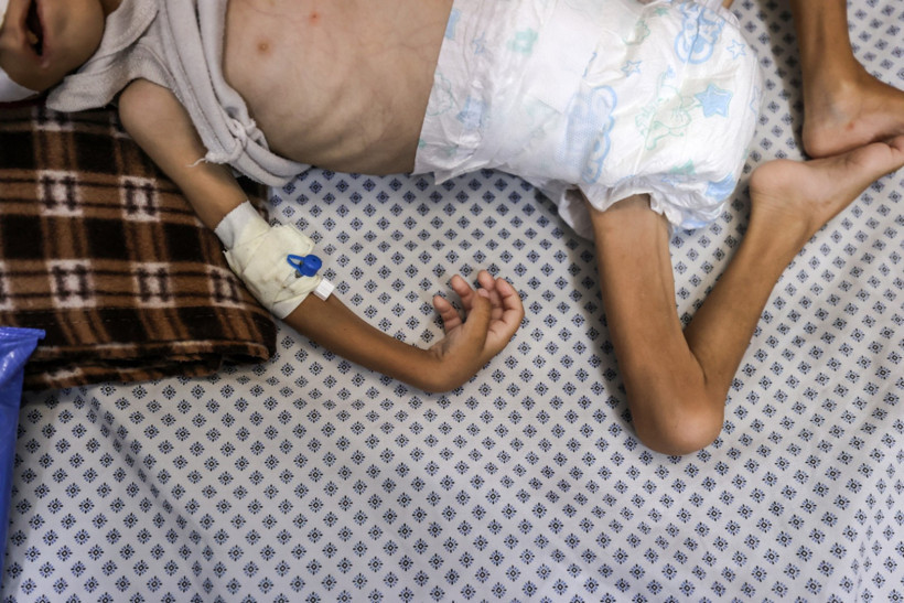 Gazze'de insanlık dramı: 8 kişi daha açlıktan öldü - Resim : 1