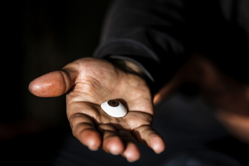 Savaşta iki kez yaralandı, gözlerini kaybetti - Resim: 2