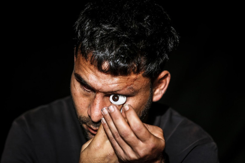 Savaşta iki kez yaralandı, gözlerini kaybetti - Resim: 3