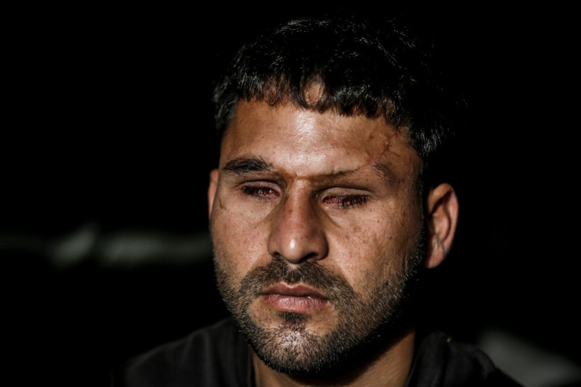 Savaşta iki kez yaralandı, gözlerini kaybetti - Resim: 7