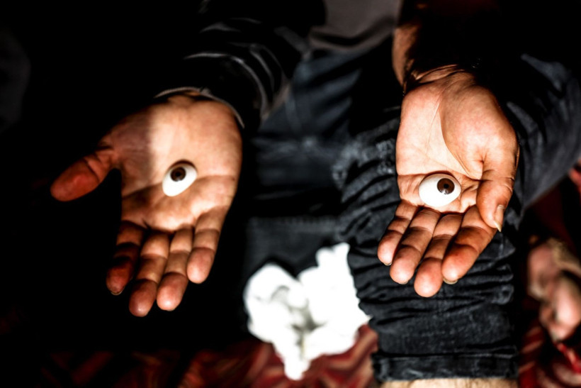 Savaşta iki kez yaralandı, gözlerini kaybetti - Resim: 8