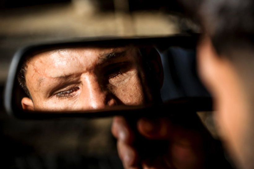 Savaşta iki kez yaralandı, gözlerini kaybetti - Resim: 9