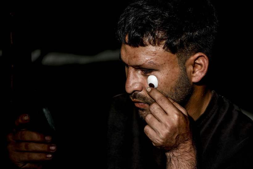 Savaşta iki kez yaralandı, gözlerini kaybetti - Resim: 10