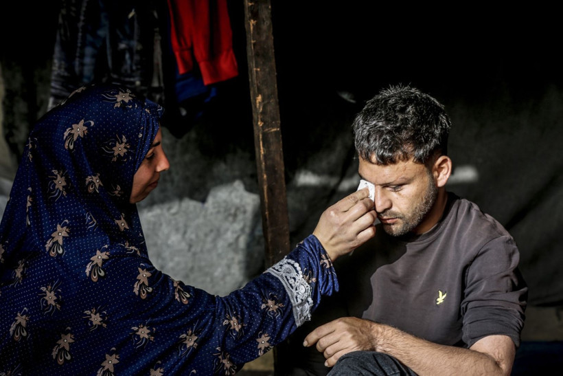 Savaşta iki kez yaralandı, gözlerini kaybetti - Resim: 11