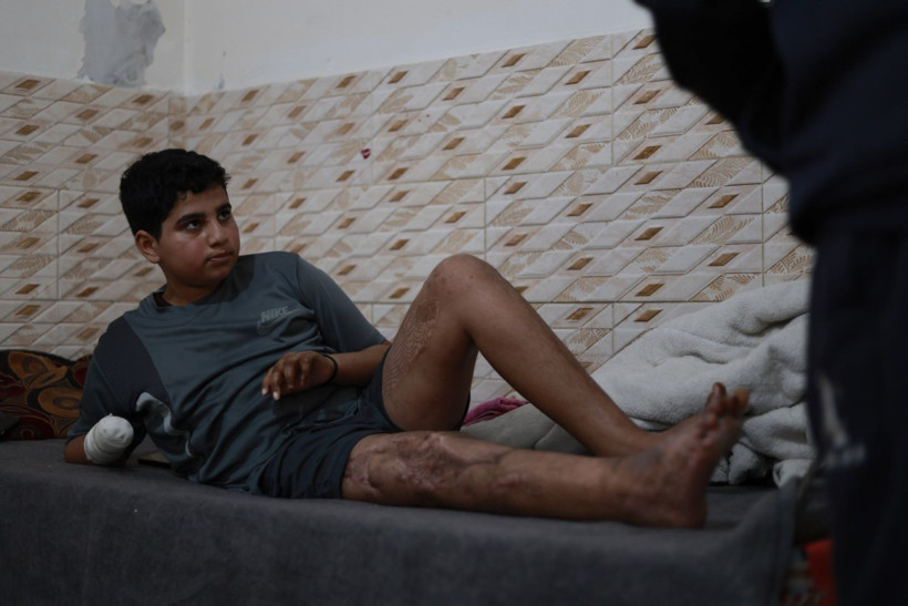 Futbol oynarken bulduğu mühimmatı eve götürdü, elini kaybetti - Resim: 1