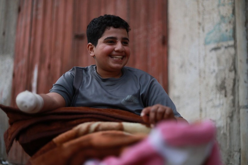 Futbol oynarken bulduğu mühimmatı eve götürdü, elini kaybetti - Resim: 3